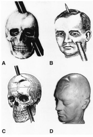phineas_gage_mcmillan
